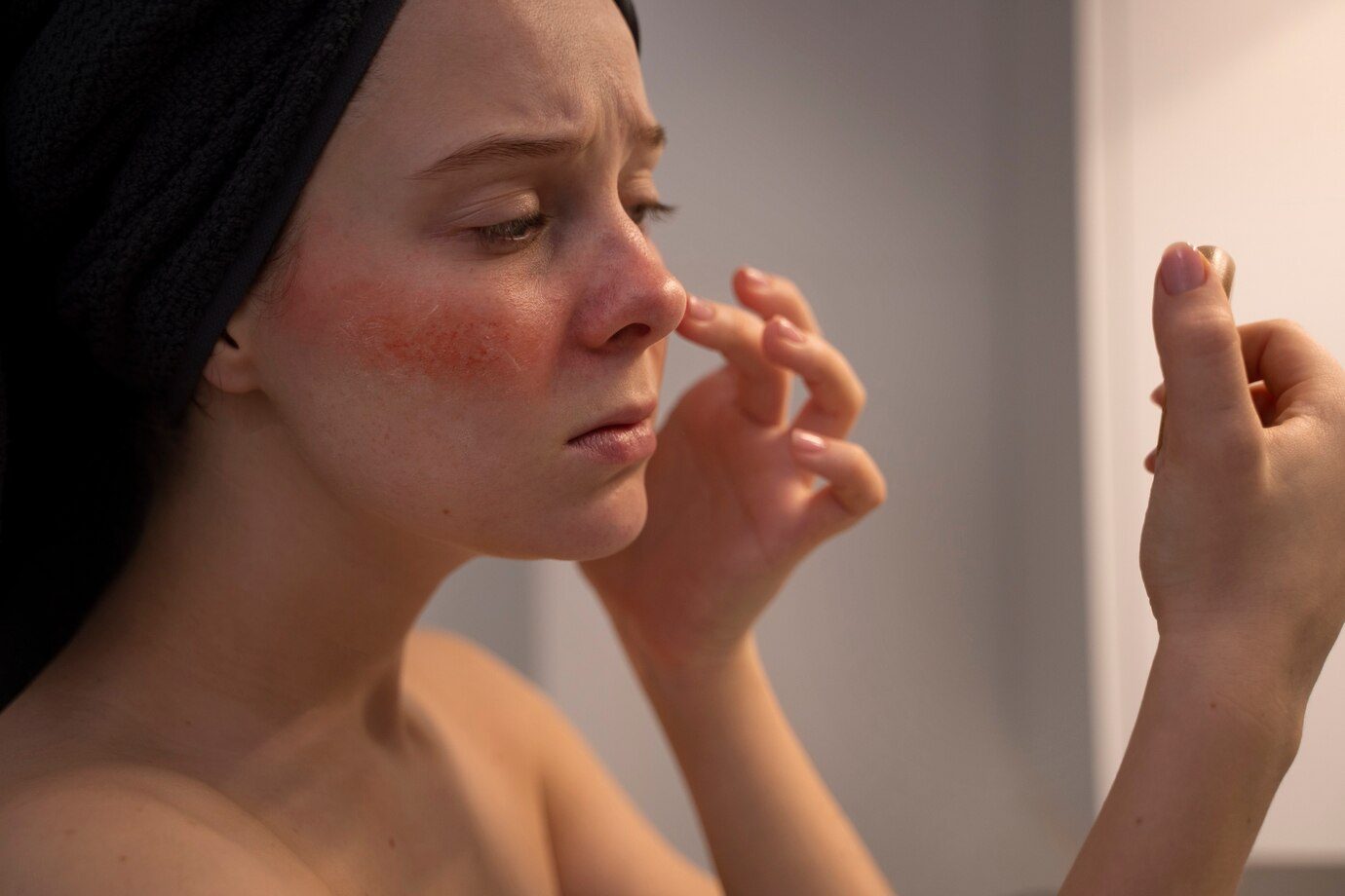 Solutions for Common Skin Concerns: Acne, Hyperpigmentation, and Dryness