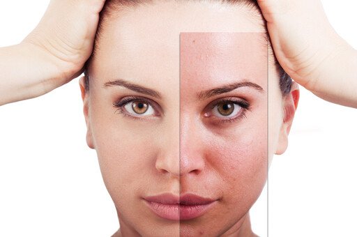 Recurbate Skincare
